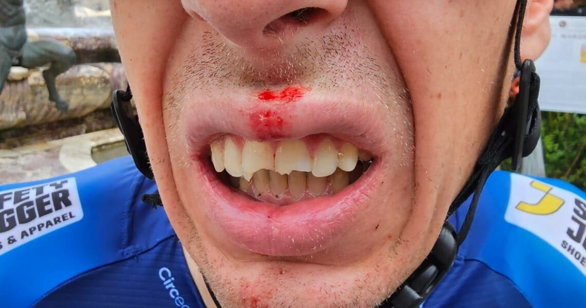 Drama i Tour de France: Krossade tänder och spya • Han vann första etappen