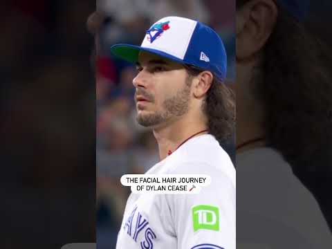 Dylan Cease’s Facial Hair Has Had A Season Of Its Own 😂